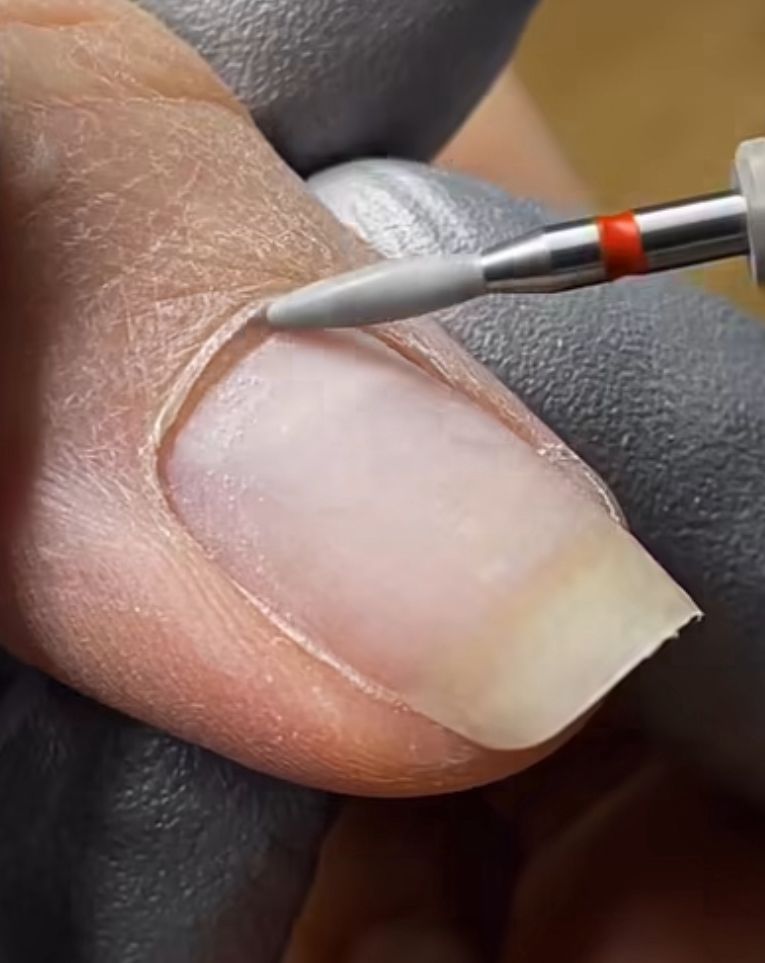 Manicure com aparelho